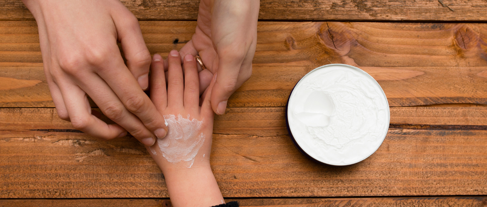 Parent helping child deal with stressful event by rubbing their hands.